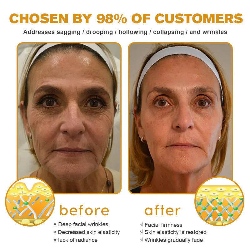 ✨Bee venom facial care ✨Smooth the Look of Wrinkles in 2 minutes — Fast, effective anti-ageing serum — save time and money