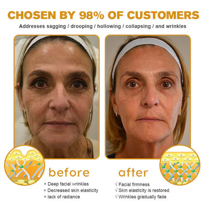 ✨Bee venom facial care ✨Smooth the Look of Wrinkles in 2 minutes — Fast, effective anti-ageing serum — save time and money