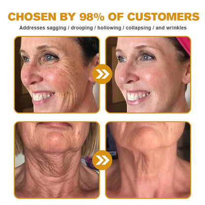 ✨Bee venom facial care ✨Smooth the Look of Wrinkles in 2 minutes — Fast, effective anti-ageing serum — save time and money