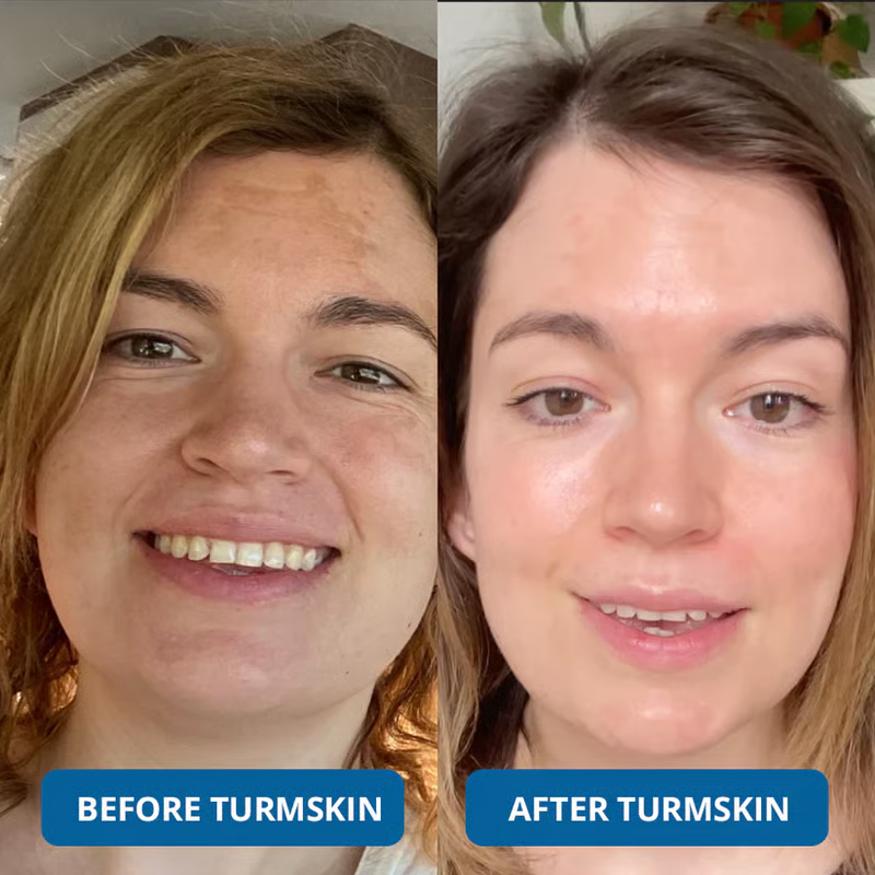 💥Buy more&Save more💥3% Hyaluronic Acid Ultra Hydrating Serum by TurmSkin