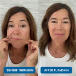 💥Buy more&Save more💥3% Hyaluronic Acid Ultra Hydrating Serum by TurmSkin